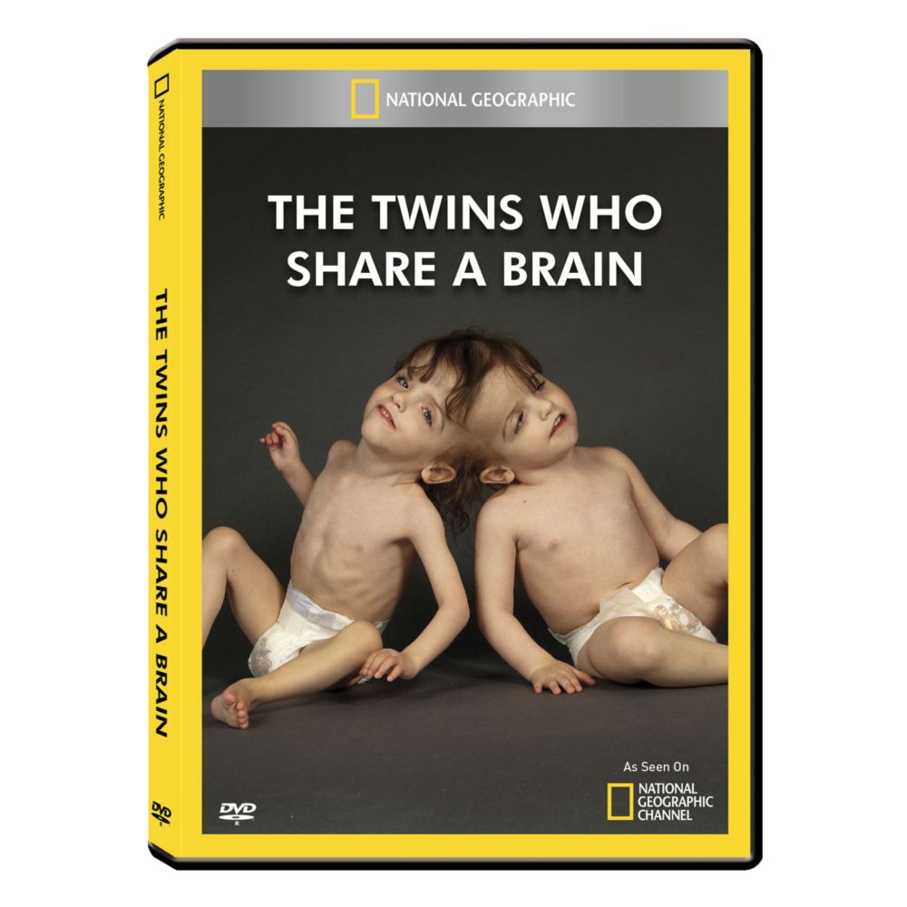Twins Who Share a Brain DVD-R