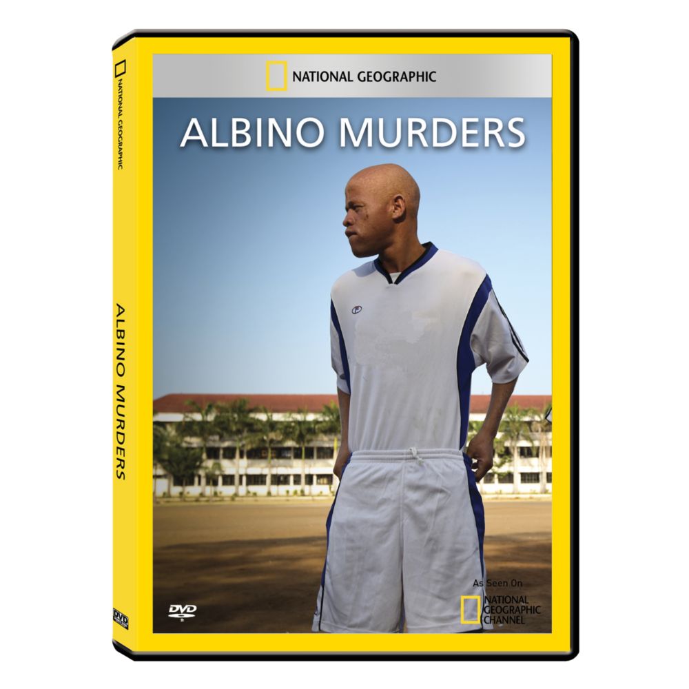 Albino Murders DVD-R