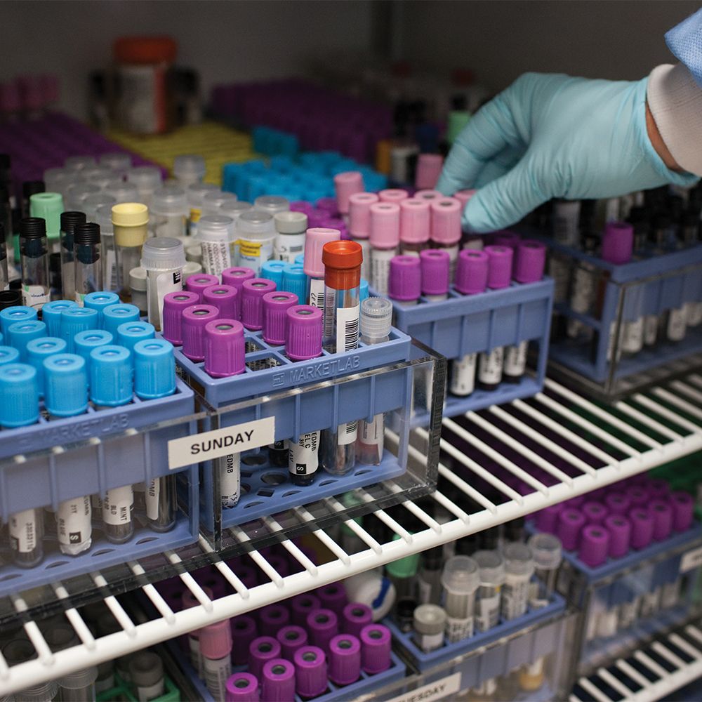 Blood Bank Analyzers