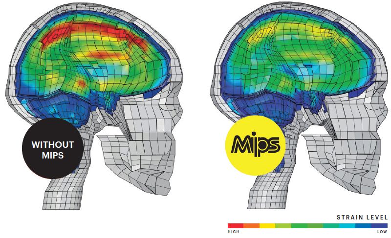 MIPS strain levels