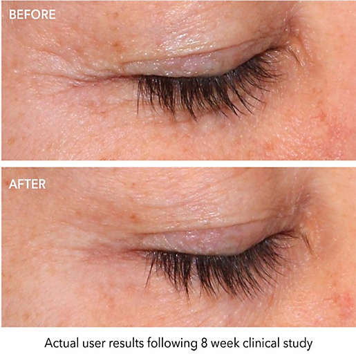 biotrue szemcsepp arc primerek száraz anti aging bőrre