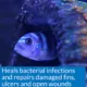 Product API® Melafix Fish Bacterial Infection Treatment