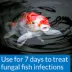 PI® Pond Pimafix Fungal Infection Treatment image thumbnail 3