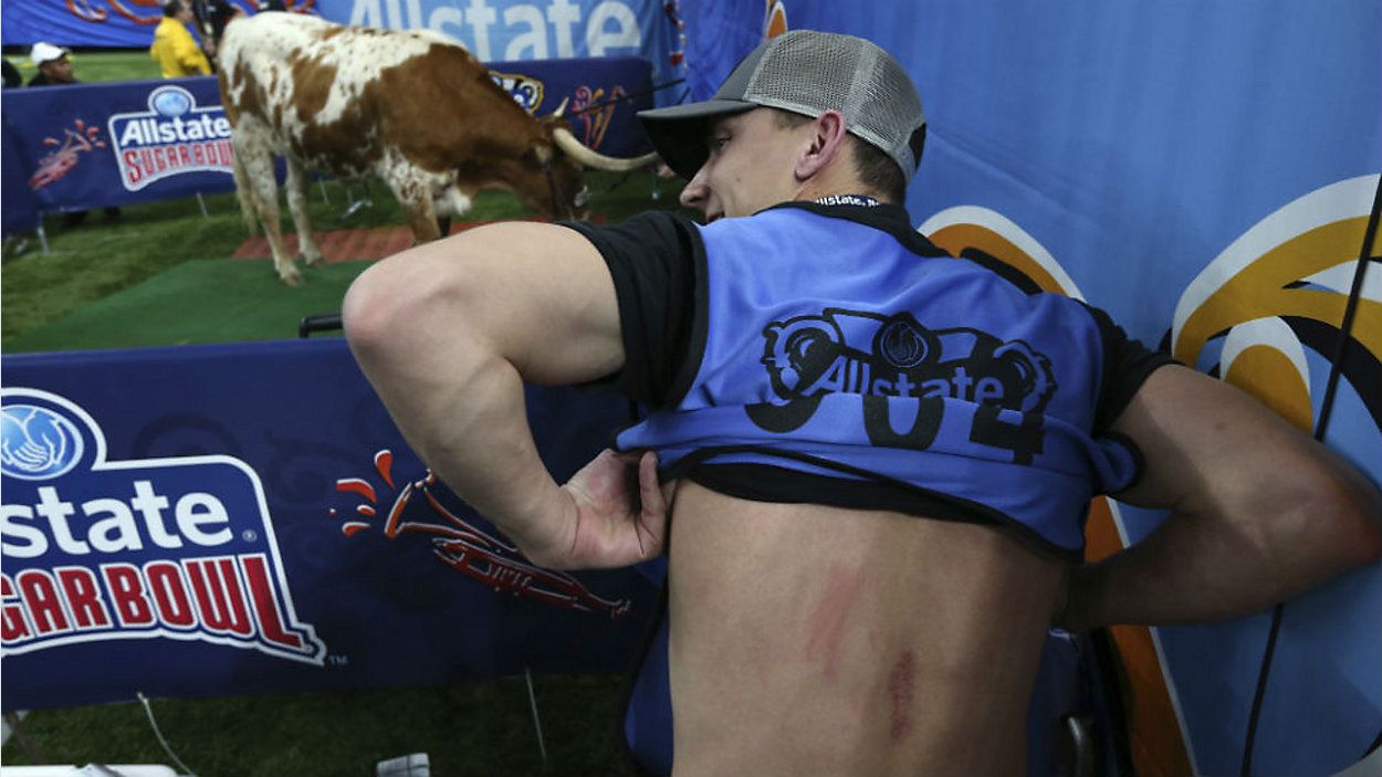 Nick Wagner, a photojournalist for the Austin American-Statesman, shows off the scrapes on his back from the Texas mascot bull "Bevo," seen in background, before the Sugar Bowl NCAA college football game against Georgia in New Orleans, Tuesday, Jan. 1, 2019. The Georgia mascot, a bulldog named "Uga X," was brought near the bull for a photo-op, when a brief kerfuffle ensued, and the photographer got scraped by Bevo's horn. (AP Photo/Rusty Costanza)