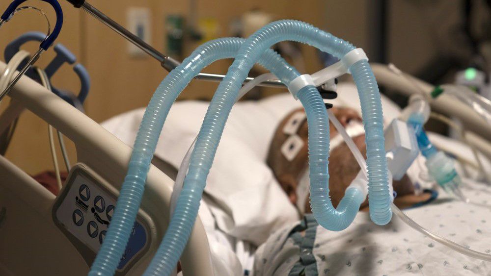 In this Nov. 19, 2020 file photo, ventilator tubes are attached to a COVID-19 patient at Providence Holy Cross Medical Center in Mission Hills. (AP/Jae C. Hong)