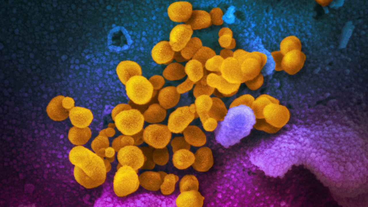 This undated electron microscope image made available by the U.S. National Institutes of Health in February 2020 shows the Novel Coronavirus SARS-CoV-2, yellow, emerging from the surface of cells, blue/pink, cultured in the lab. (NIAID-RML via AP)