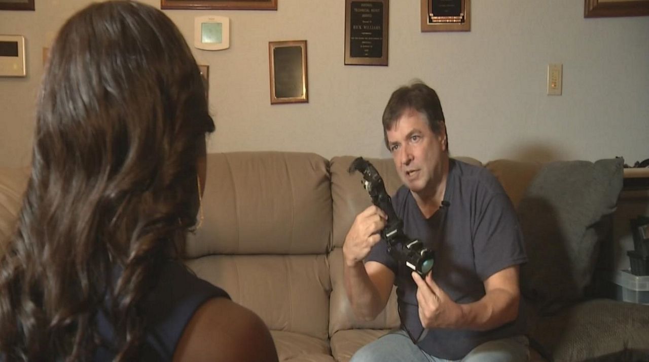 Pinellas Doctor Uses 3-D Printer To Create Life-Changing Prosthetics