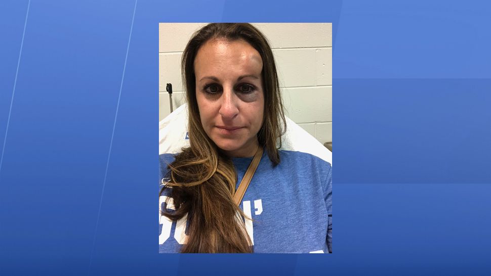 Sabrina Pattie, 39, was struck in the face by a puck flying at full speed during the Lightning-Devils playoff hockey game at Amalie Arena on Saturday, April 14, 2018. (Josh Rojas, staff)