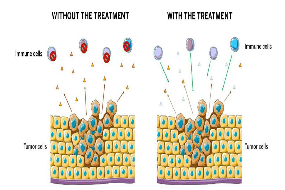 Left: Cancer manipulates your immune system to support tumor growth by sending signals to your immune cells to turn off. Right: The UT team’s treatment degrades that signal and allows your immune system to fight the cancer. Illustration by Norah Ashoura, molecular biology graduate student in the College of Natural Sciences