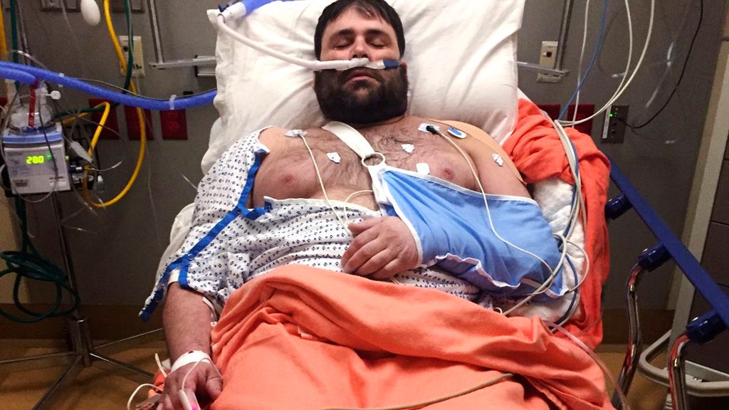 In this photograph provided by Kerry Smith, Jeffery Smith rests in a hospital bed after injuries sustained in a snowmobile crash at Baystate Medical Center, April 16, 2019, in Springfield, Mass. Jeffrey Smith has filed suit against the government to pay nearly $10 million after being badly injured in a snowmobile crash with a Black Hawk helicopter. Smith's snowmobile collided with a helicopter that was parked on a Massachusetts snow-covered trail at dusk. (Kerry Smith photo via AP)
