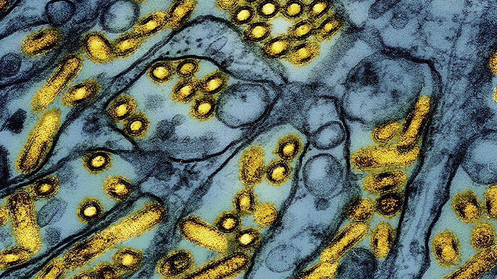 This colorized electron microscope image released by the National Institute of Allergy and Infectious Diseases on March 26, 2024, shows avian influenza A H5N1 virus particles (yellow), grown in Madin-Darby Canine Kidney (MDCK) epithelial cells (blue). (CDC/NIAID via AP)