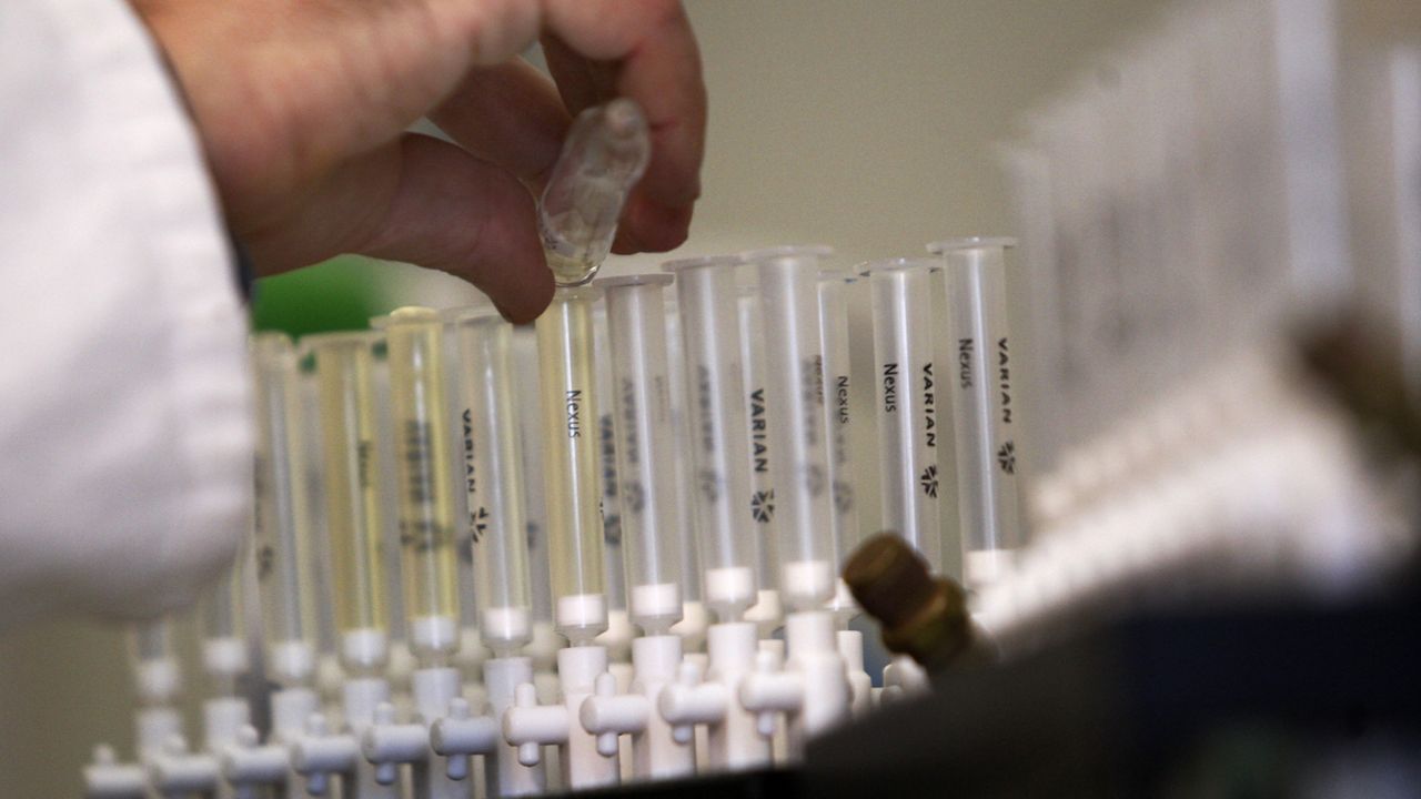 In this Feb. 5, 2010, file photo, a laboratory technician prepares samples of urine for doping tests during a media open day, at the King's College Drug Control Centre in London. (AP Photo/Sang Tan)