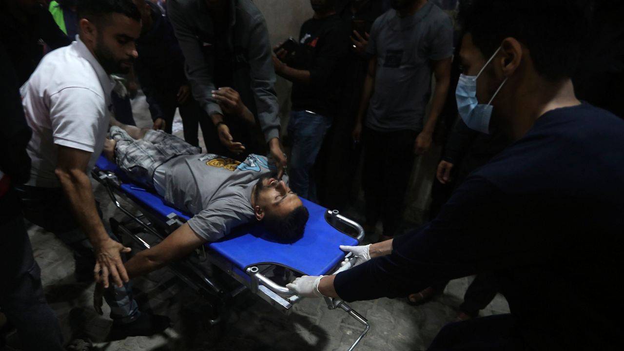 A Palestinian wounded in the Israeli bombardment of the Gaza Strip is brought to the Kuwaiti Hospital in Rafah refugee camp, southern Gaza Strip, early Saturday, April 20, 2024. (AP Photo/Ismael Abu Dayyah)