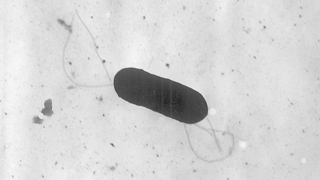 This 2002 electron microscope image made available by the Centers for Disease Control and Prevention shows a Listeria monocytogenes bacterium, responsible for the food borne illness listeriosis. (Elizabeth White/CDC via AP, File)