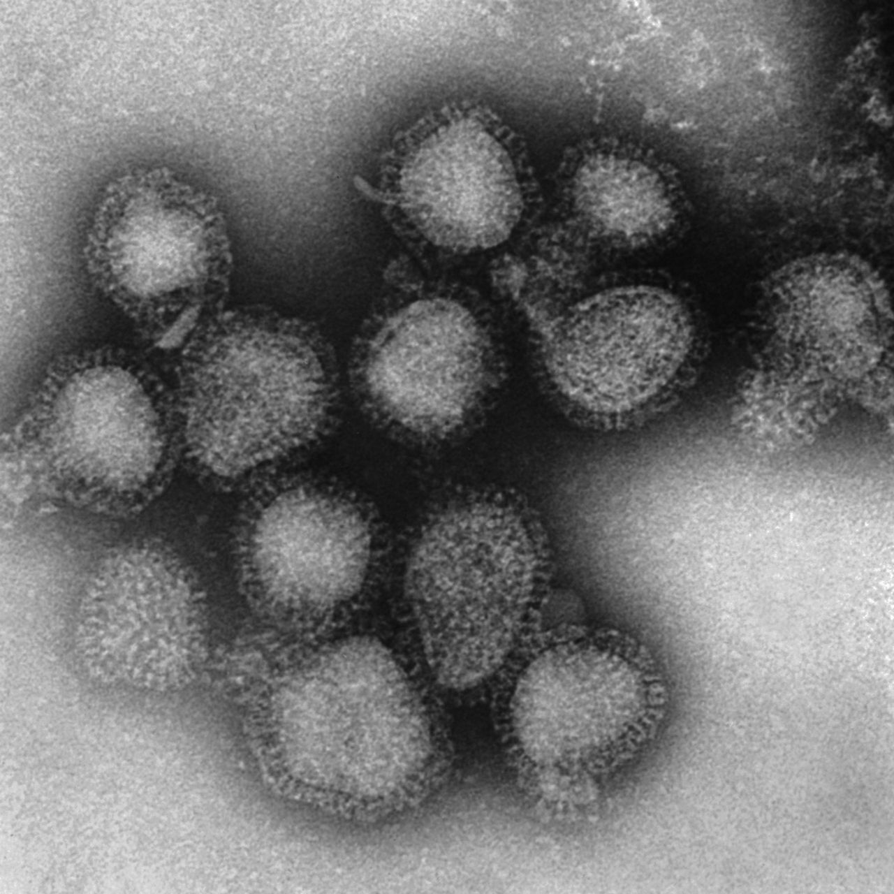 Flu In May 2025