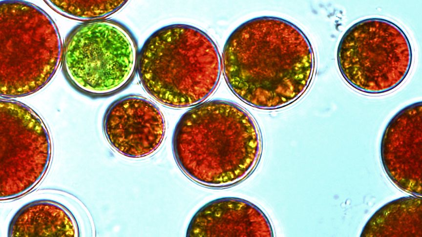 Algae under the microscope (Photo courtesy of University of Hawaii)