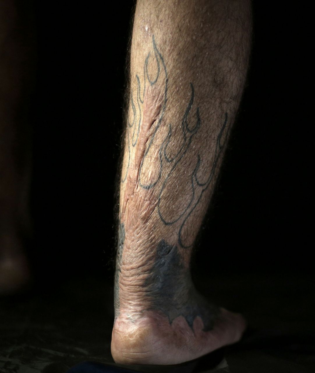 AP PHOTOS Iraqis seek tattoos to cover scars of war