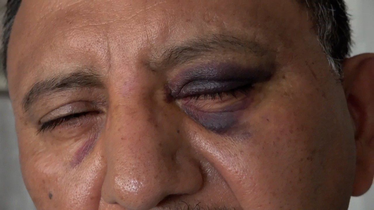 Street vendor says he was attacked in Long Beach on Fourth of July