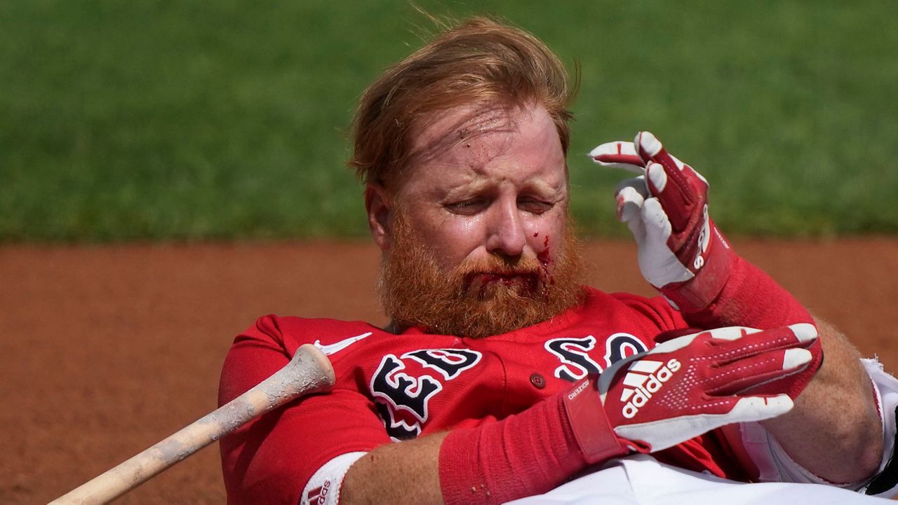 Red Sox's Justin Turner transported after being hit in the face by a pitch