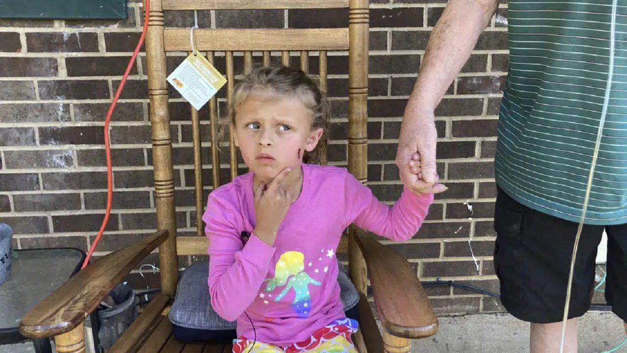 Kinsley White, 6, shows reporters a wound left on her face, Thursday in Gastonia, N.C. A North Carolina man shot and wounded a 6-year-old girl and her parents after children went to retrieve a basketball that had rolled into his yard, according to neighbors and the girl's family. (Kara Fohner/The Gaston Gazette via AP)