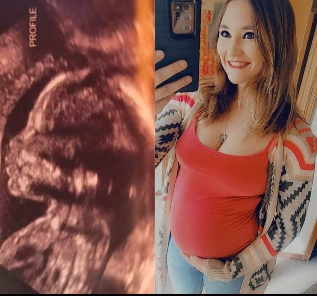 Kaitlyn Anderson and a sonogram of her unborn son Jaxx (Courtesy: Tabatha Moore)