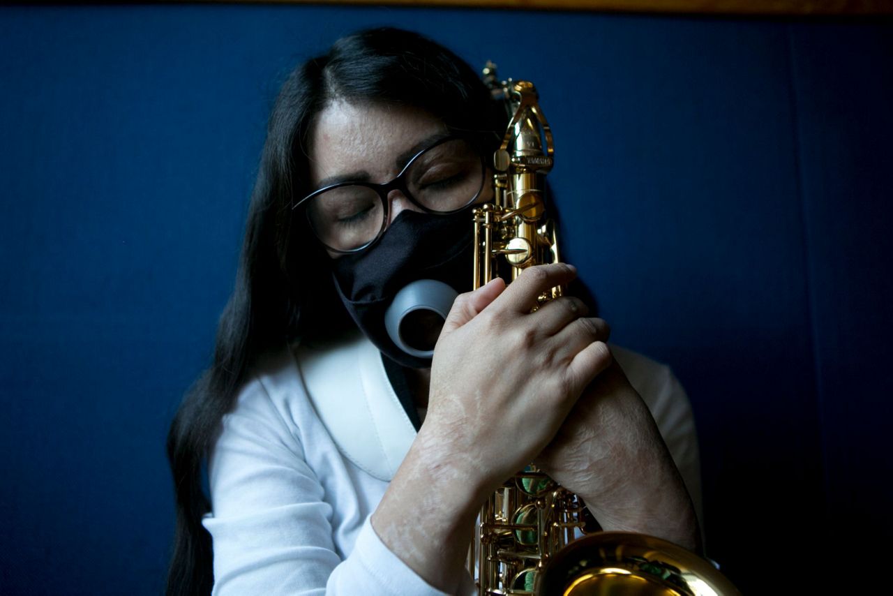 Mexican musician finds refuge in saxophone after acid attack