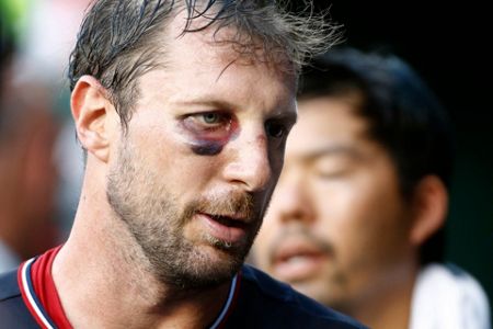 Max Scherzer strikes out 10 with broken nose in shutout win over Phillies