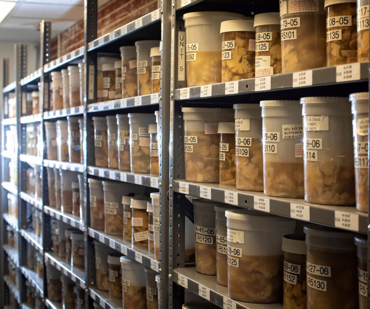 Scientists rethink Alzheimer's, diversifying the drug search