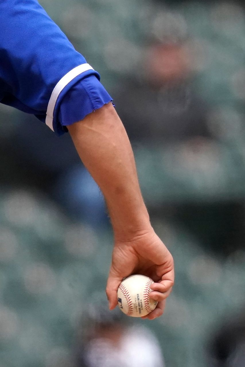 Bad baseballs? New York Mets angry after rash of HBPs