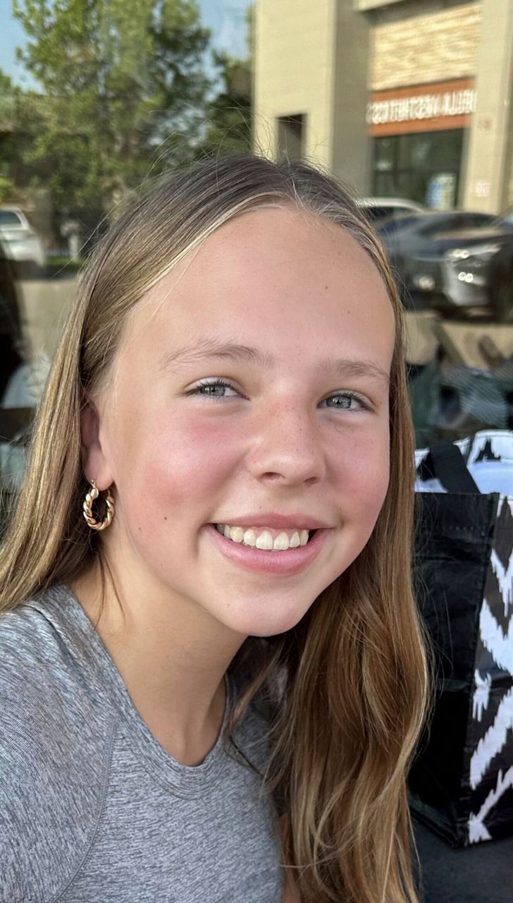 Girl shot in the head in Minneapolis church attack is making ...
