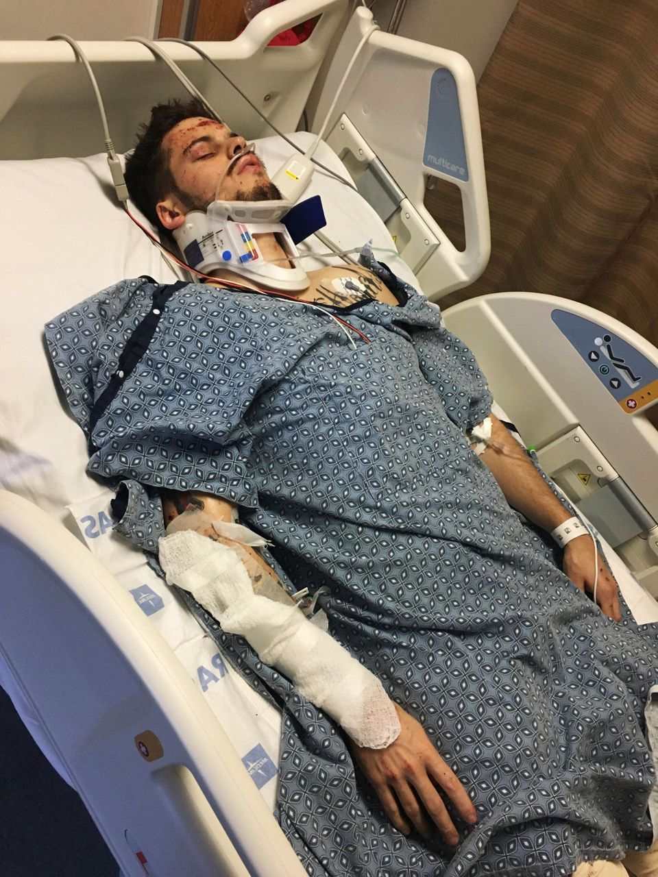 Boom in electric scooters leads to more injuries, fatalities