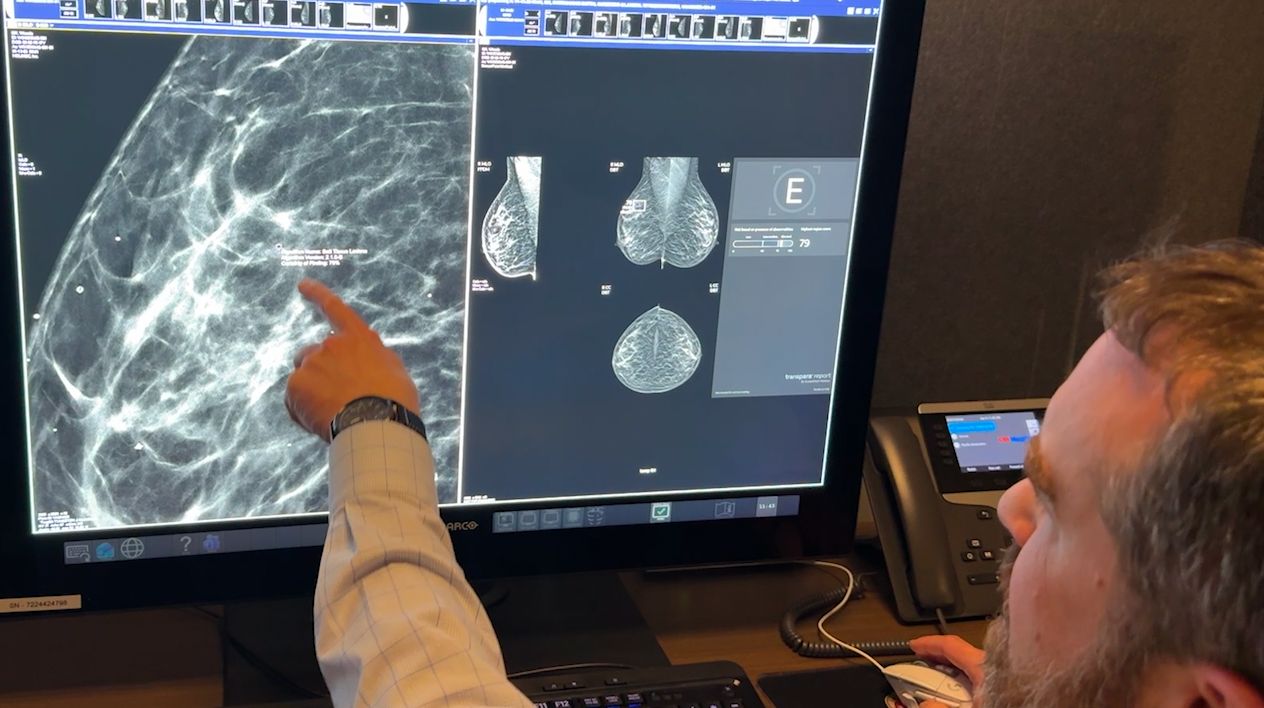 AI benefits Wisconsin health experts