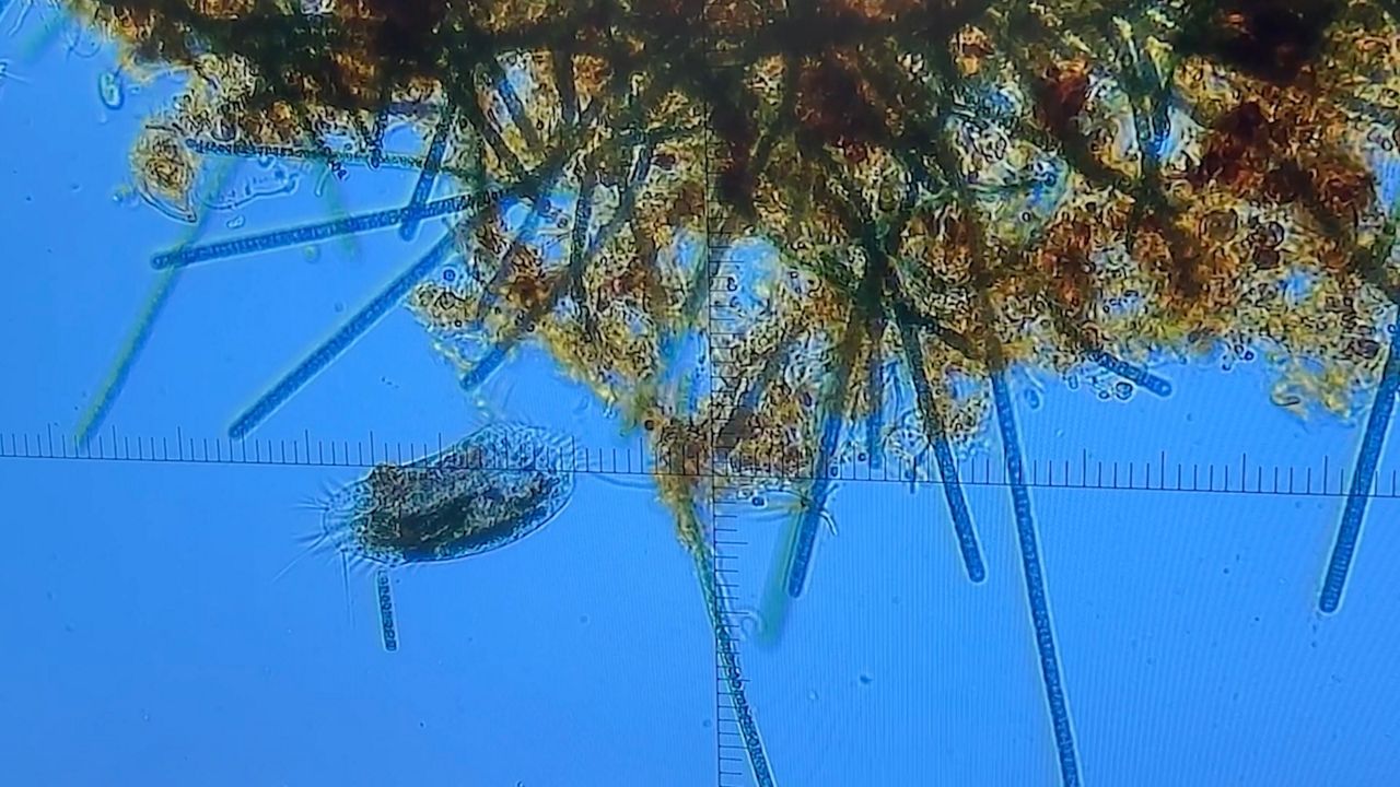 Algae under a microscope (Spectrum News 1/Jenna Rae Gaertner)