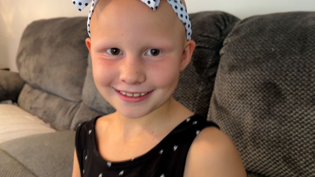 8-year-old goes viral after alopecia diagnosis