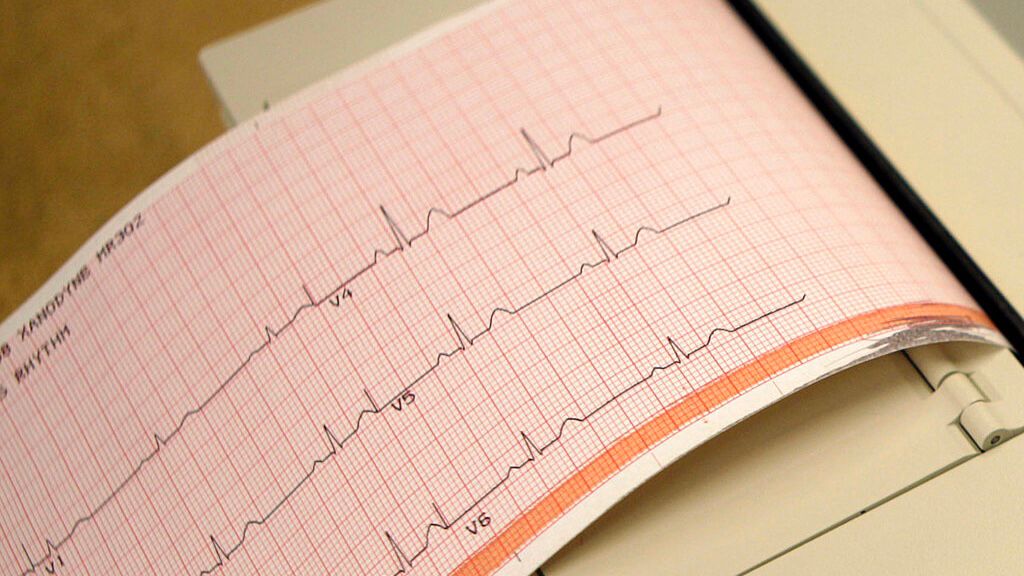 Rochester Üniversitesi Tıp Merkezi, implante edilebilir defibrilatörlere yönelik araştırmalara 27 milyon dolar yatırım yapacak