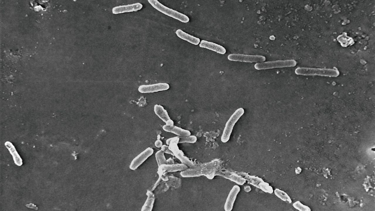 This scanning electron microscope image made available by the Centers for Disease Control and Prevention shows rod-shaped Pseudomonas aeruginosa bacteria. U.S. health officials are advising people to stop using the over-the-counter eye drops, EzriCare Artificial Tears, that have been linked to an outbreak of drug-resistant infections of Pseudomonas aeruginosa. The Centers for Disease Control and Prevention on Wednesday night, Feb. 1, 2023, sent a health alert to physicians, saying the outbreak includes at least 55 people in 12 states. One died. (Janice Haney Carr/CDC via AP)