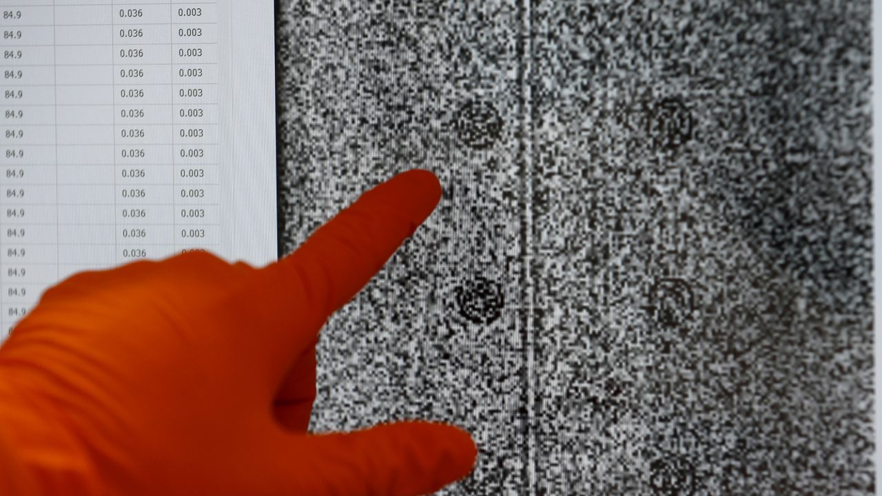 FILE: A lab assistant points at a picture of a cluster of Covid-19 RNA molecules on a computer screen. (AP Photo/Frank Augstein)