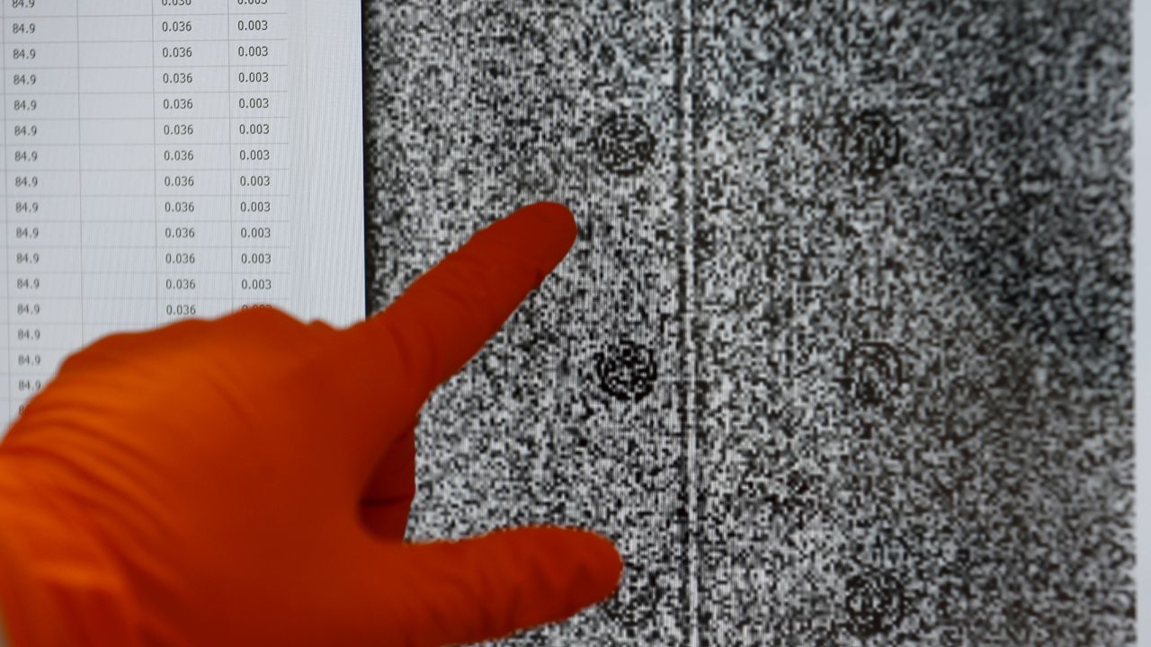 FILE: A lab assistant points at a picture of a cluster of Covid-19 RNA molecules on a computer screen Thursday, March 4, 2021. (AP Photo/Frank Augstein)