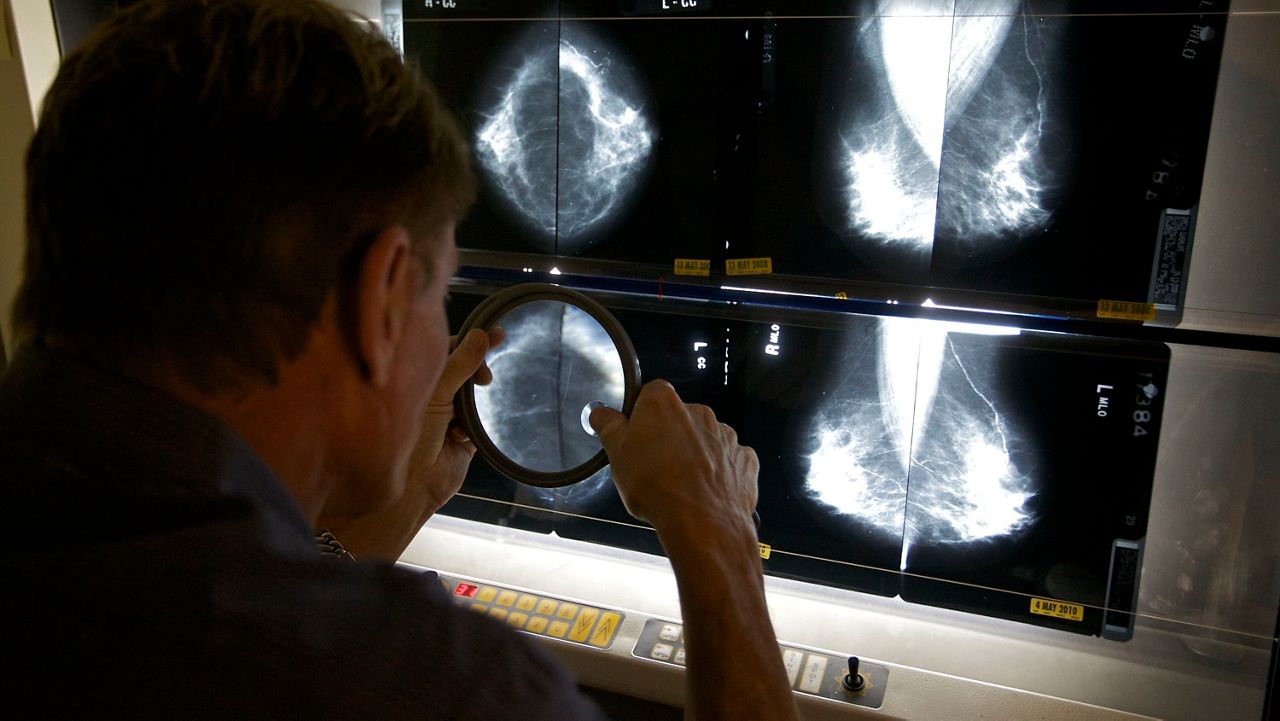Study links elevated pollution levels to breast cancer