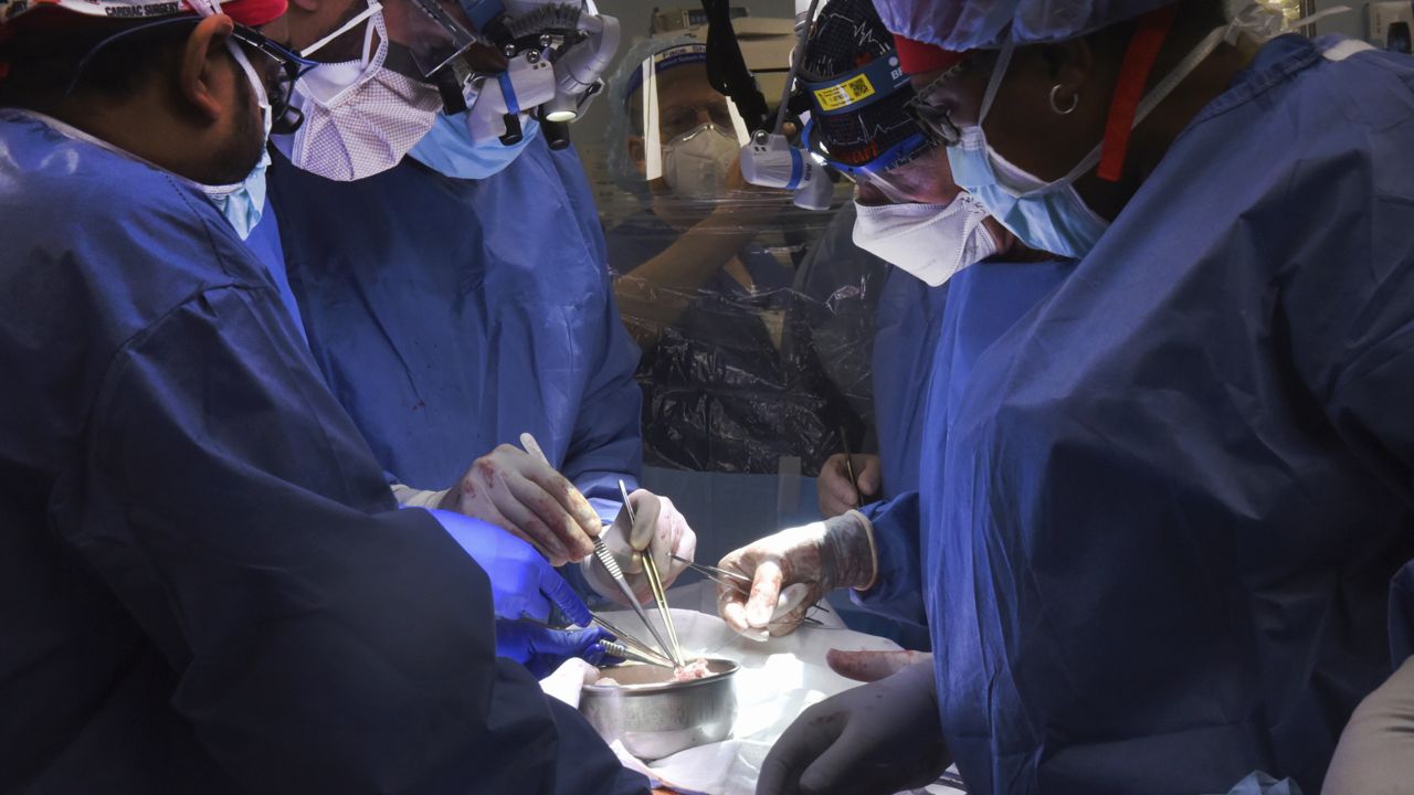 A surgical team performs the transplant of a pig heart into patient David Bennett in Baltimore on Friday, Jan. 7, 2022. On Monday, Jan. 10, 2022 the hospital said that he's doing well three days after the highly experimental surgery. (Mark Teske/University of Maryland School of Medicine via AP)
