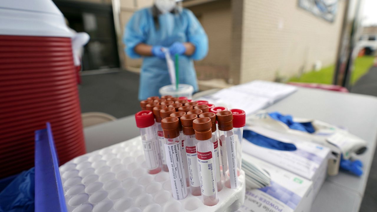 Test kits sit on a table as a healthcare professional prepares to take a sample. Officials are urging approximately 300 teenagers get tested for the novel coronavirus after attending a party in Lakeway, Texas, last weekend. (AP Photo/David J. Phillip)