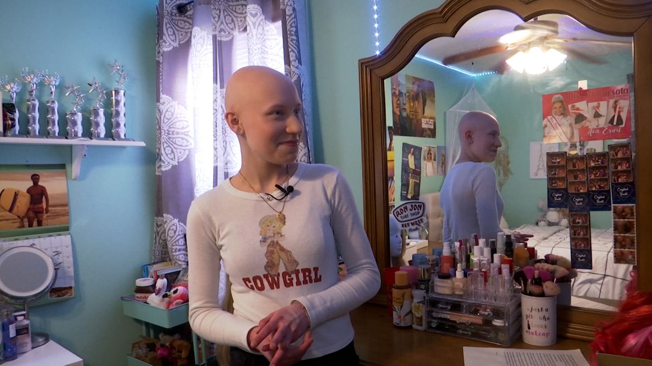 Wisconsin middle schooler shares experience with alopecia - Vimarsana News
