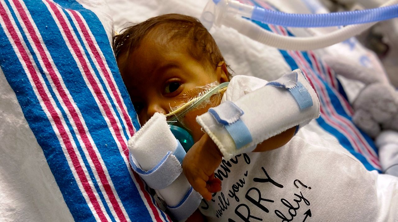 Queens baby survives rare liver transplant 