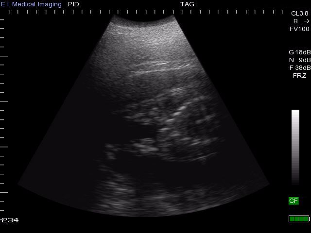 A photo of the ultrasound performed on Bibi to confirm the pregnancy. (Photo courtesy of Cincinnati Zoo and Botanical Garden)