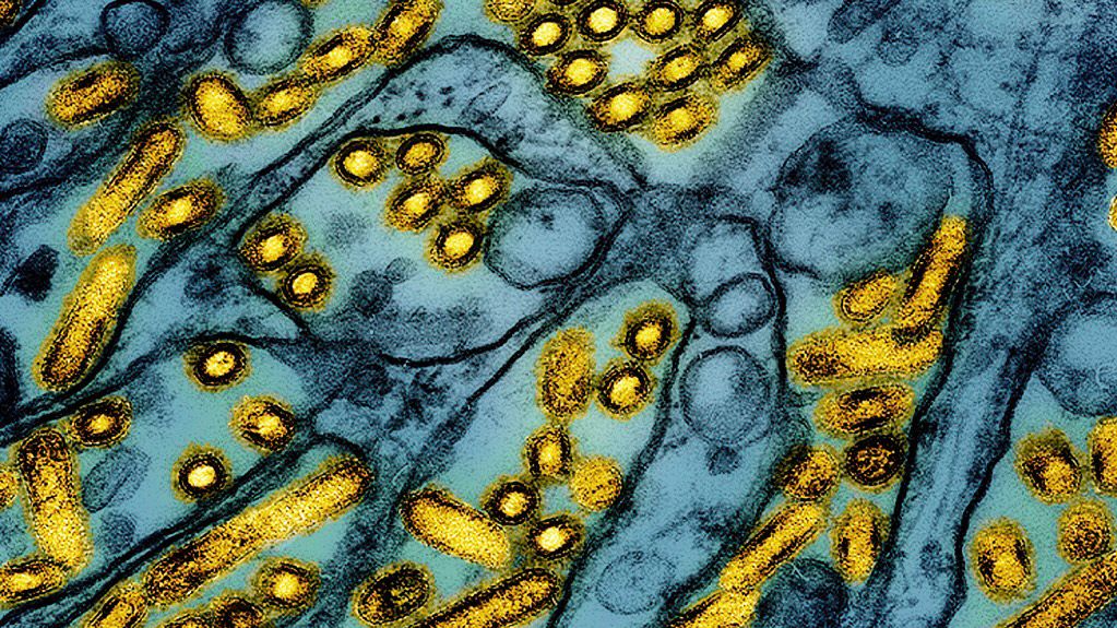 This colorized electron microscope image released by the National Institute of Allergy and Infectious Diseases on March 26, 2024, shows avian influenza A H5N1 virus particles (yellow), grown in Madin-Darby Canine Kidney (MDCK) epithelial cells (blue). (CDC/NIAID via AP, File)