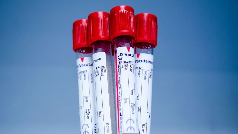 FILE- Blood collection tubes. 