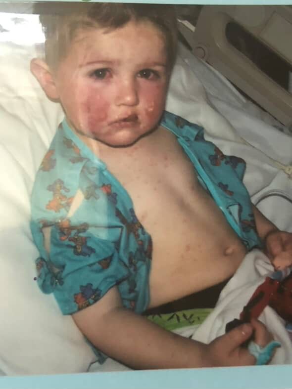 Brendon Brown is legally blind after suffering from an allergic reaction as a kid. (Brendon Brown)