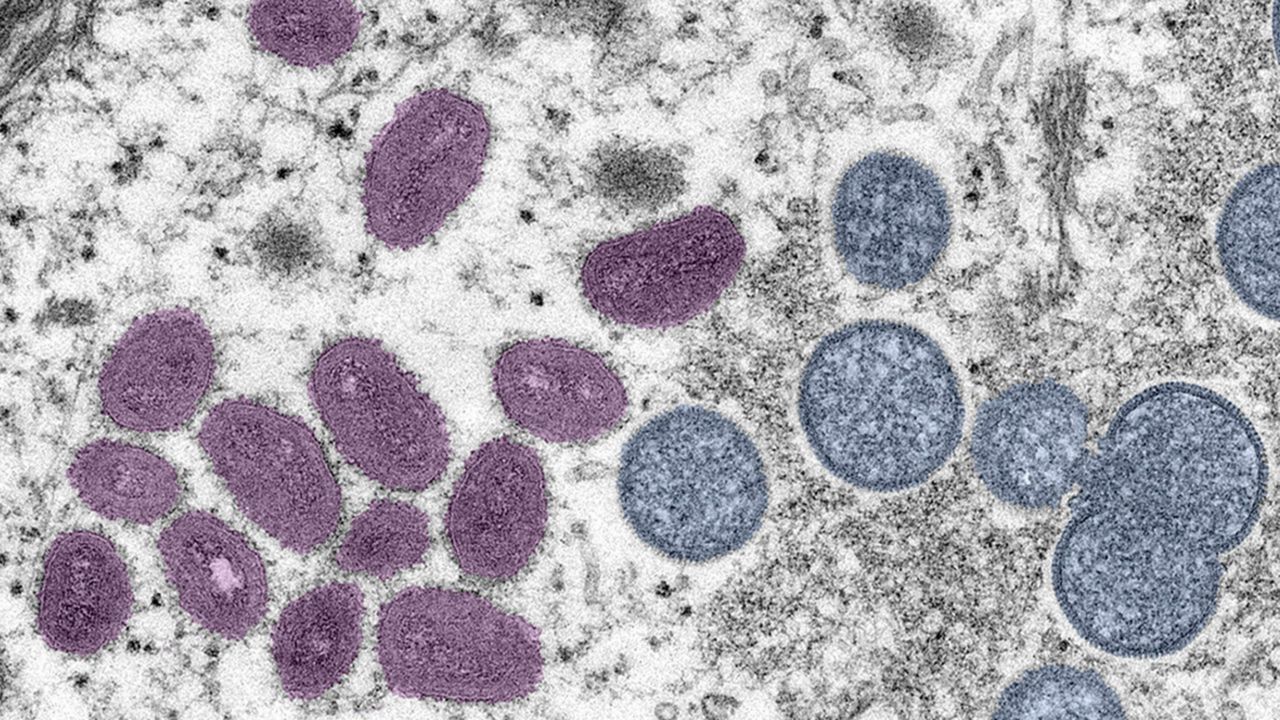 Monkeypox virus. (Photo Courtesy CDC)