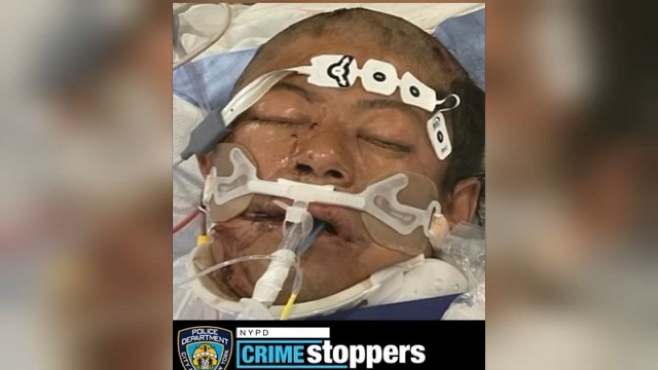 “Help Identify Hispanic Cyclist in Critical Condition After Accident in Brooklyn”