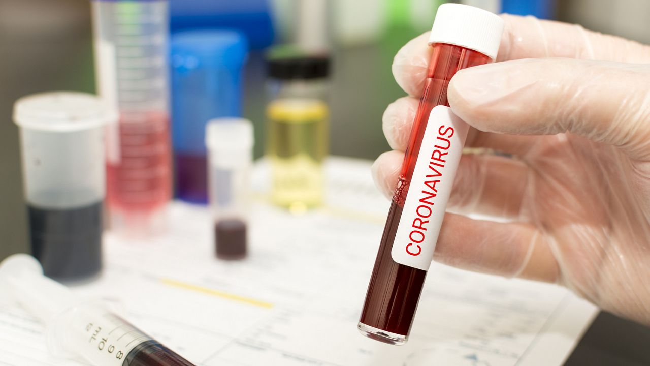 Photo of coronavirus-positive blood